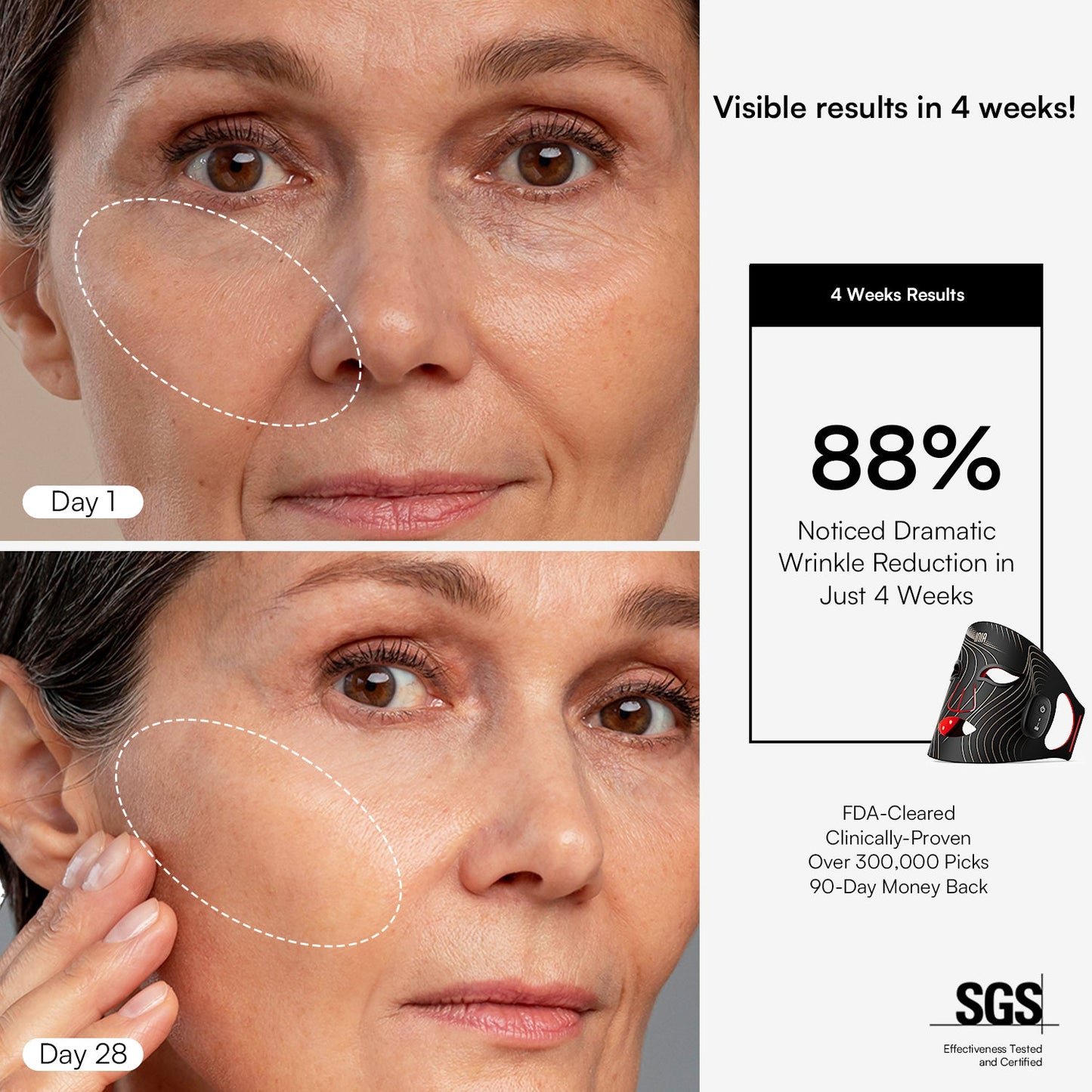 Elynia GLOW Wireless Red Light Therapy Mask