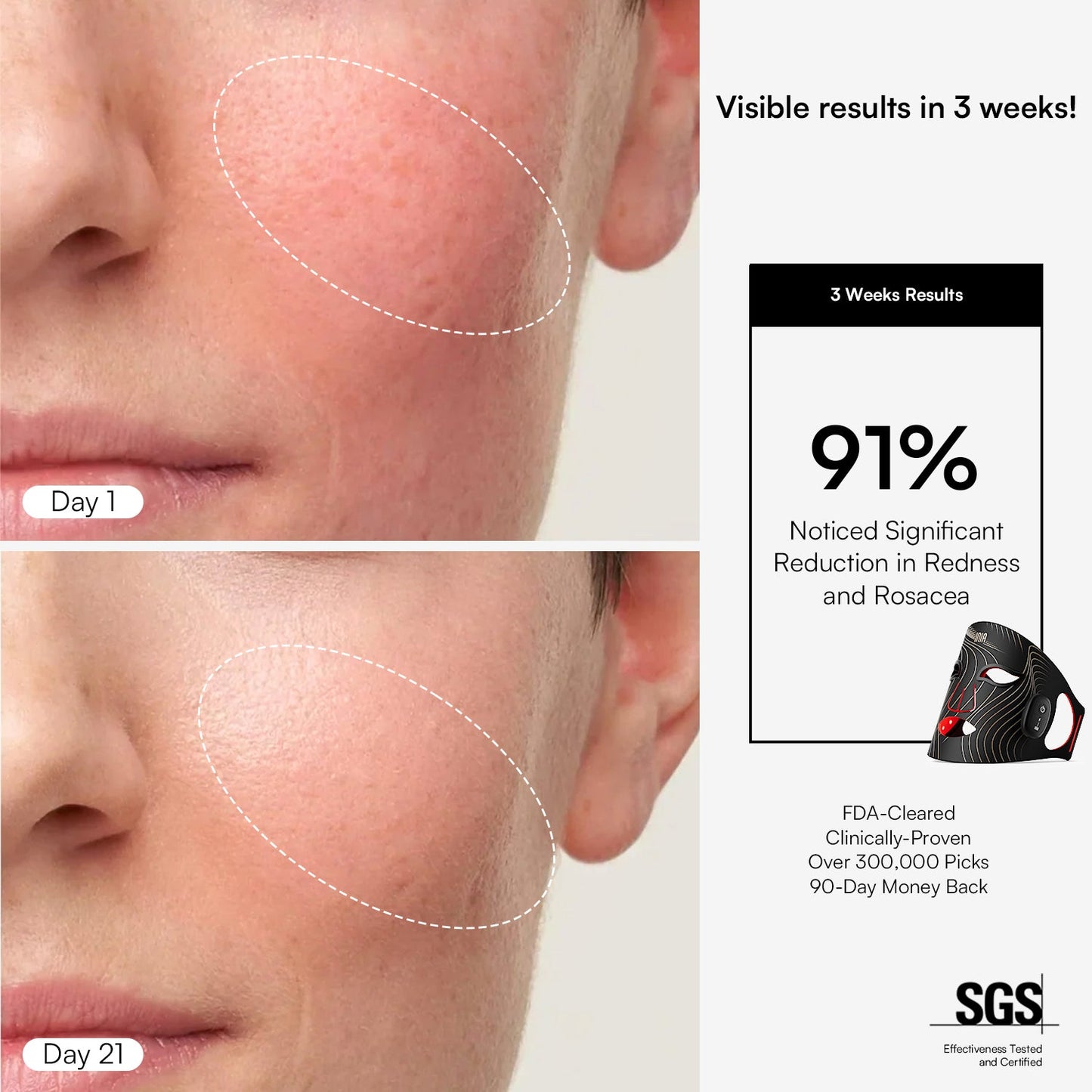 Elynia GLOW Wireless Red Light Therapy Mask