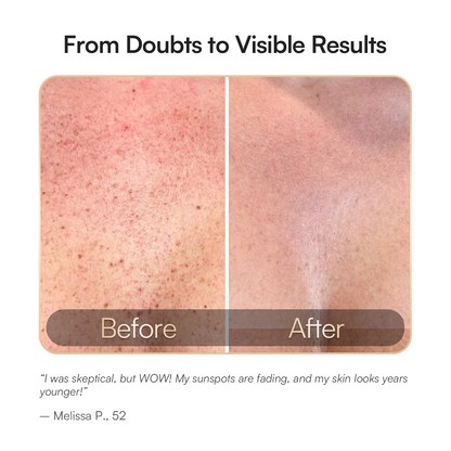 Elynia GLOW Neck & Chest Red Light Therapy