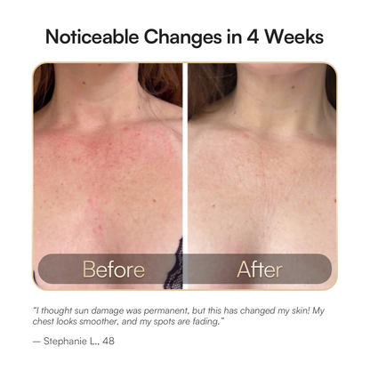 Elynia GLOW Neck & Chest Red Light Therapy